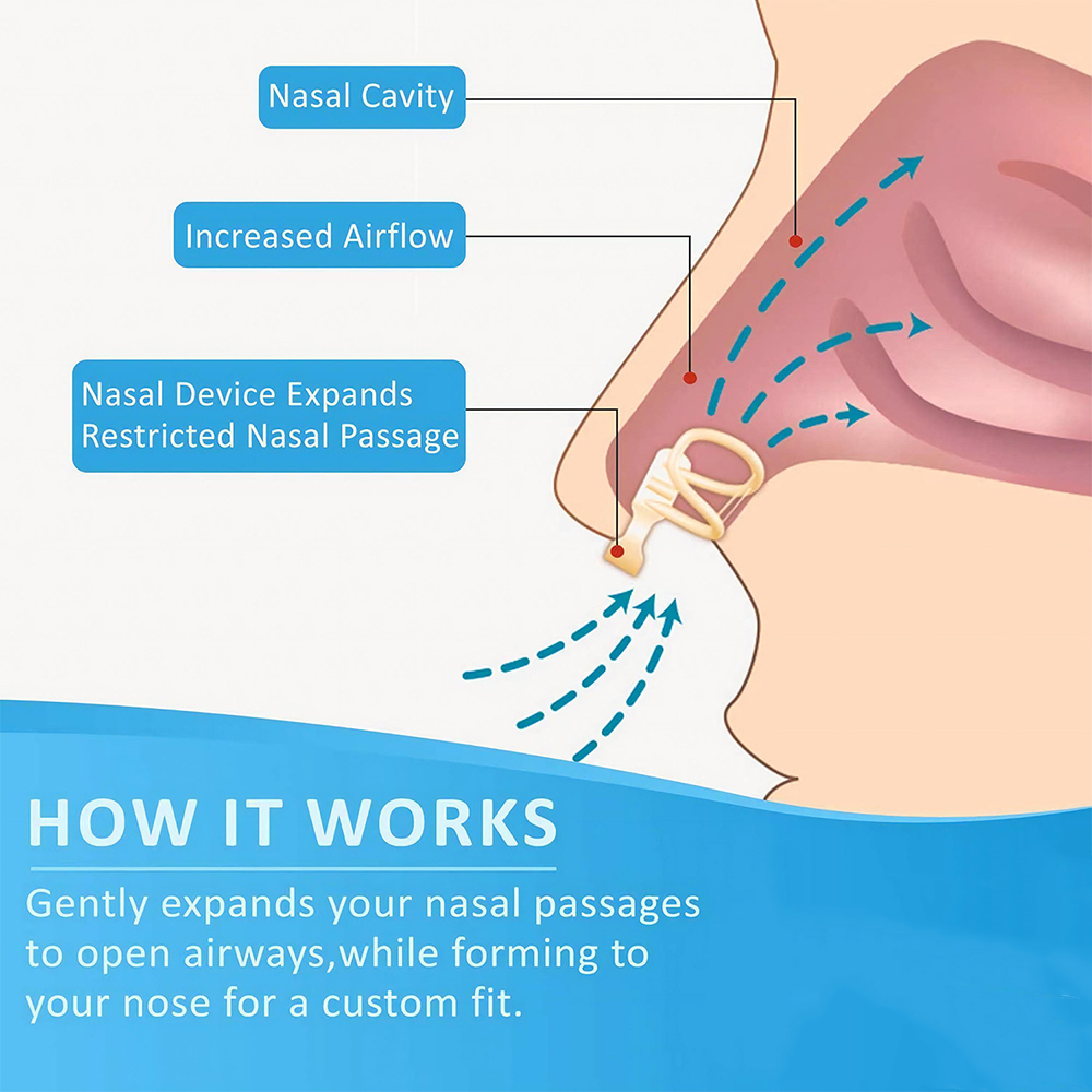 Snore Stopper Nasal Dilator fo - Anti Snore Contour Pillow review and price